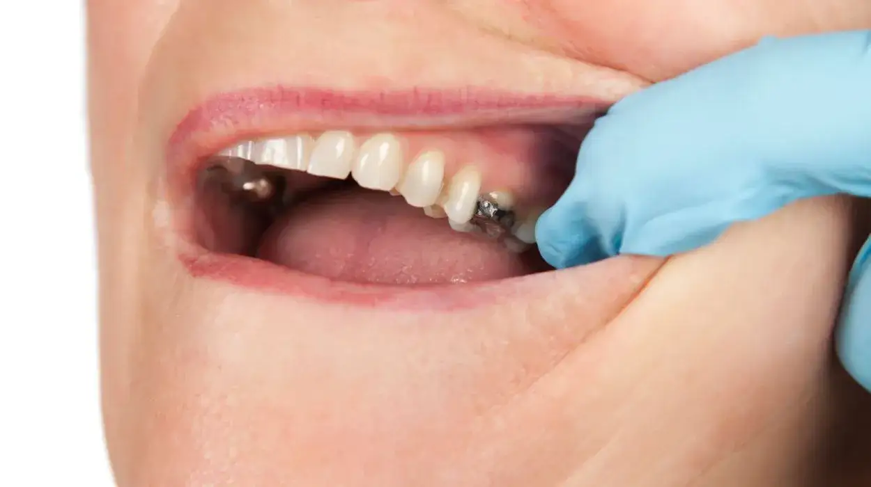 Drenaż ropnia dziąsła u dentysty