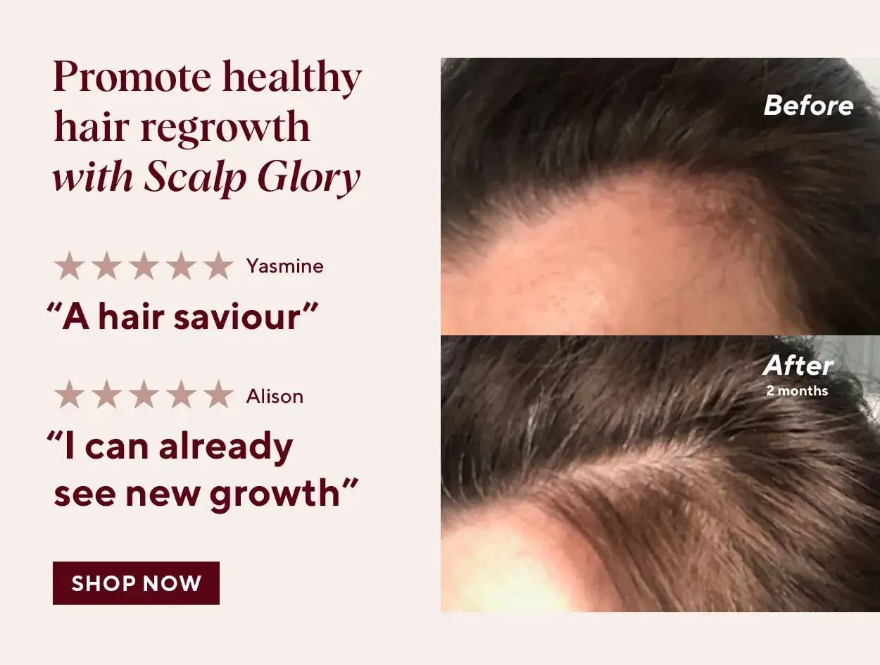 Pomoc w walce co na wypadające włosy po ciąży. Zdjęcia 