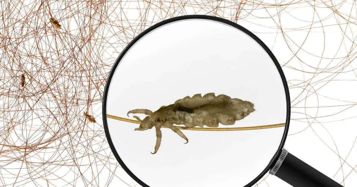 Zdjęcie Jak się rozmnażają wszy? Poznaj ich cykl życia i jak ich unikać