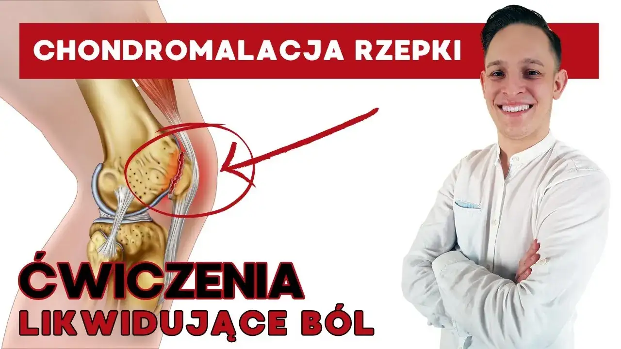Bezpieczne ćwiczenia chondromalacja rzepki