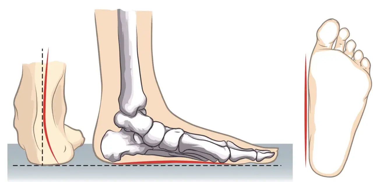 budowa stopy dziecka anatomia