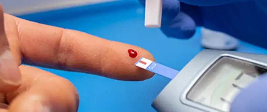 Pobieranie krwi glukoza na czczo