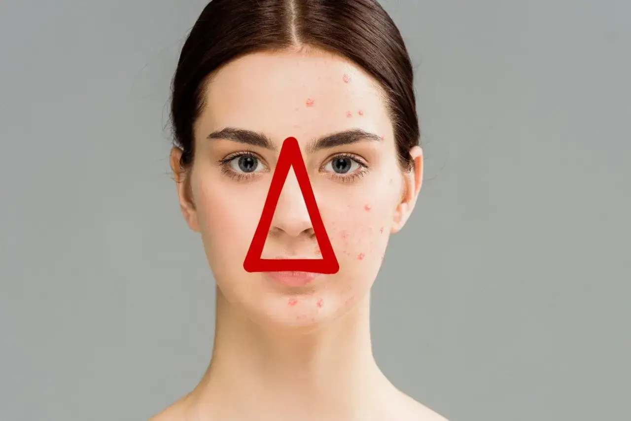 Mapa twarzy trójkąt śmierci