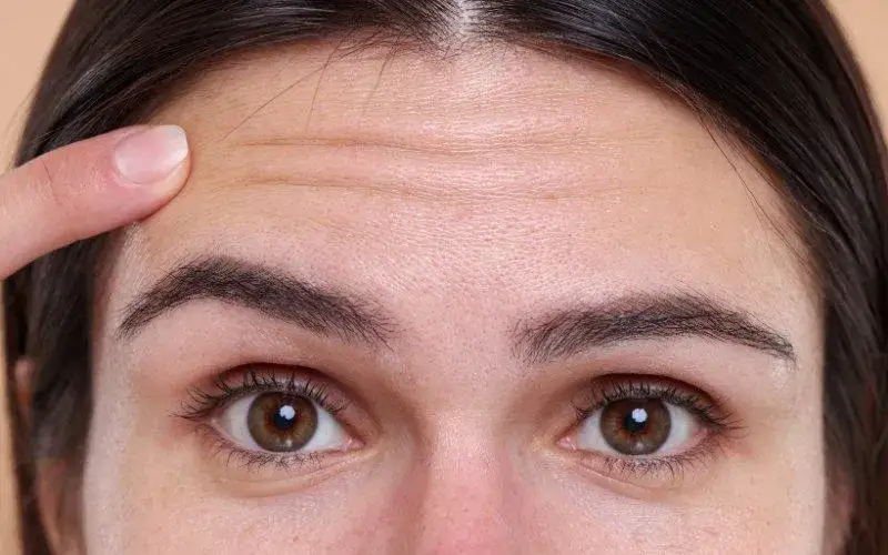 Zdjęcie Skuteczne metody wygładzania zmarszczek na czole, które działają