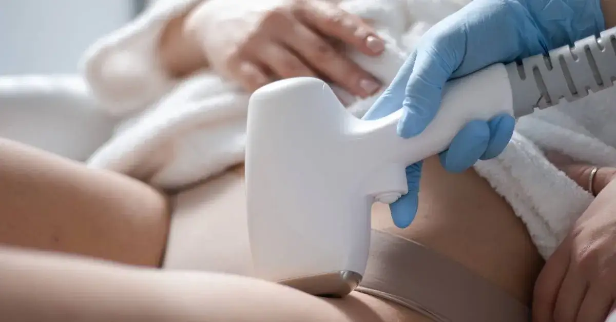 Mapa wrażliwości ciała na ból depilacji laserowej