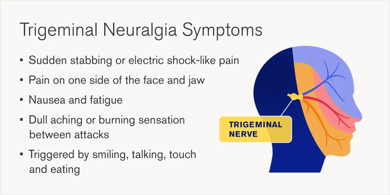 Ból szczęki na tle nerwowym. Objawy: nagły, kłujący ból, zmęczenie, nudności. Nerw trójdzielny.