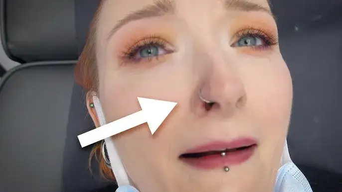 etapy gojenia kolczyka w nosie