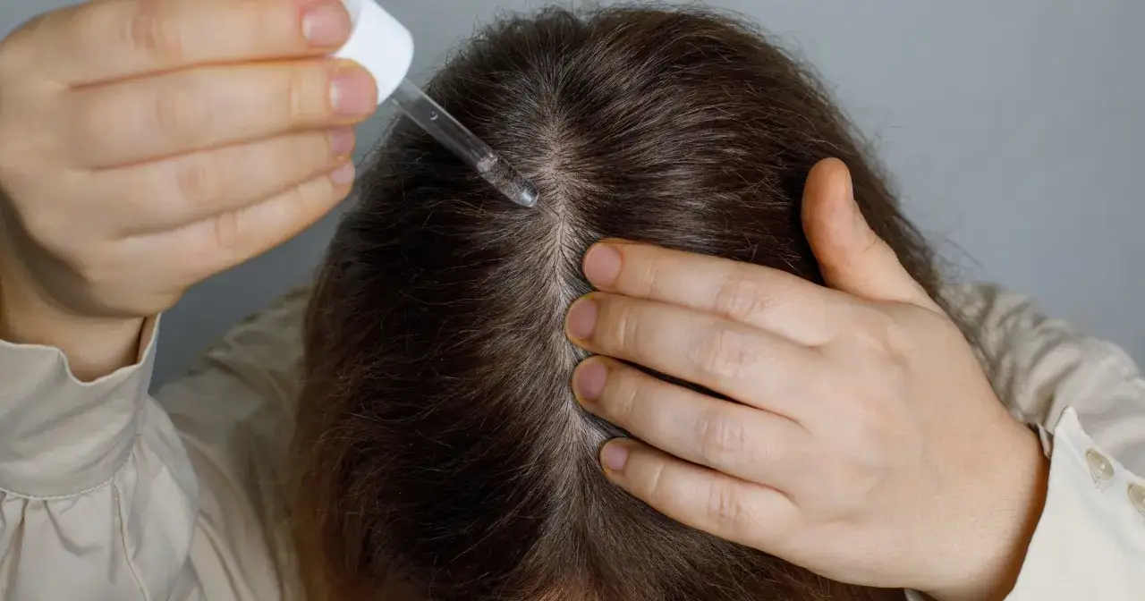 Kobieta aplikuje serum na skórę głowy. Czy serum do włosów się spłukuje? To pytanie nurtuje wiele osób dbających o kondycję włosów.