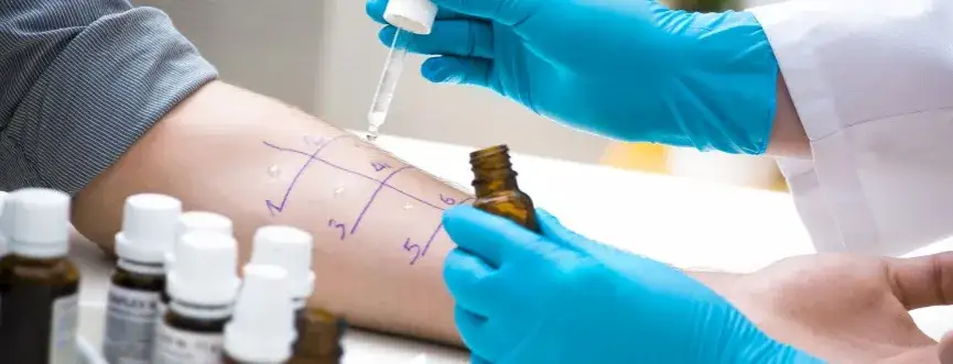 testy alergiczne sk&oacute;rne krew