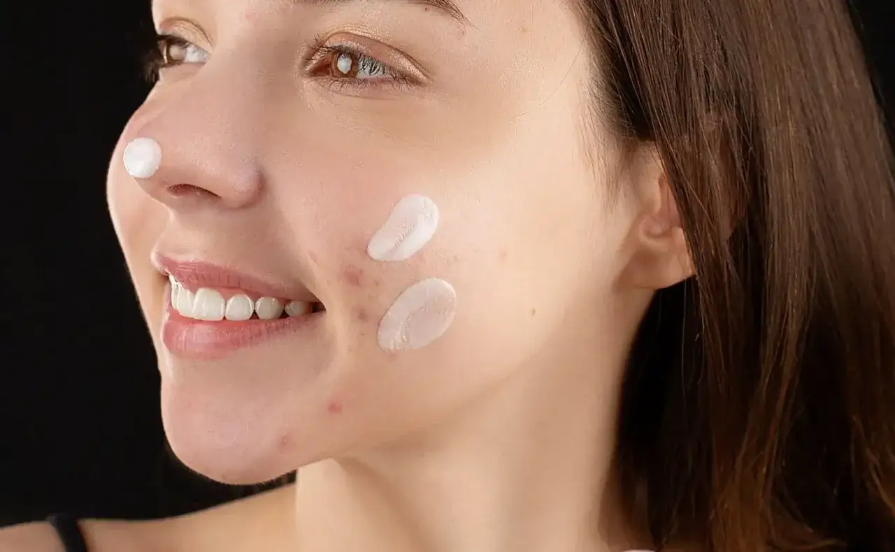 Przyczyny pryszczy na brodzie