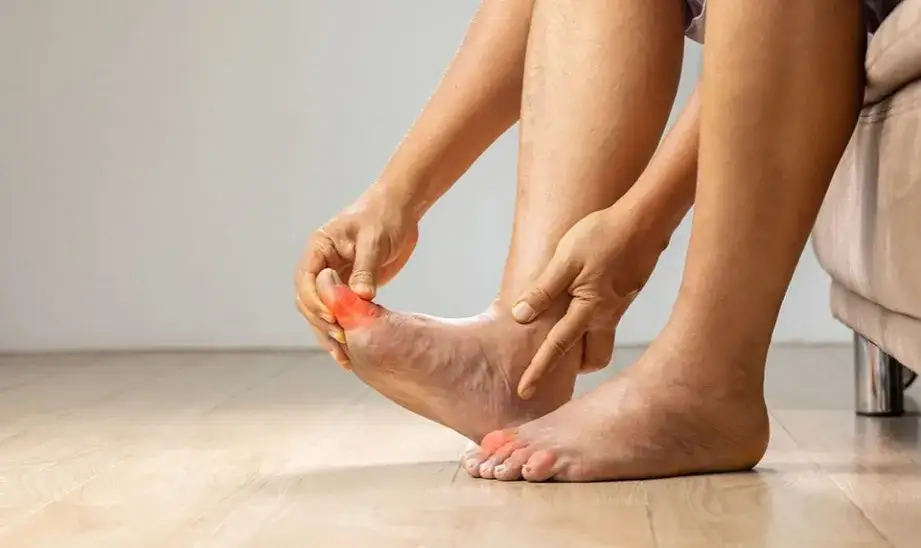 badanie płynu stawowego kryształy moczanu sodu