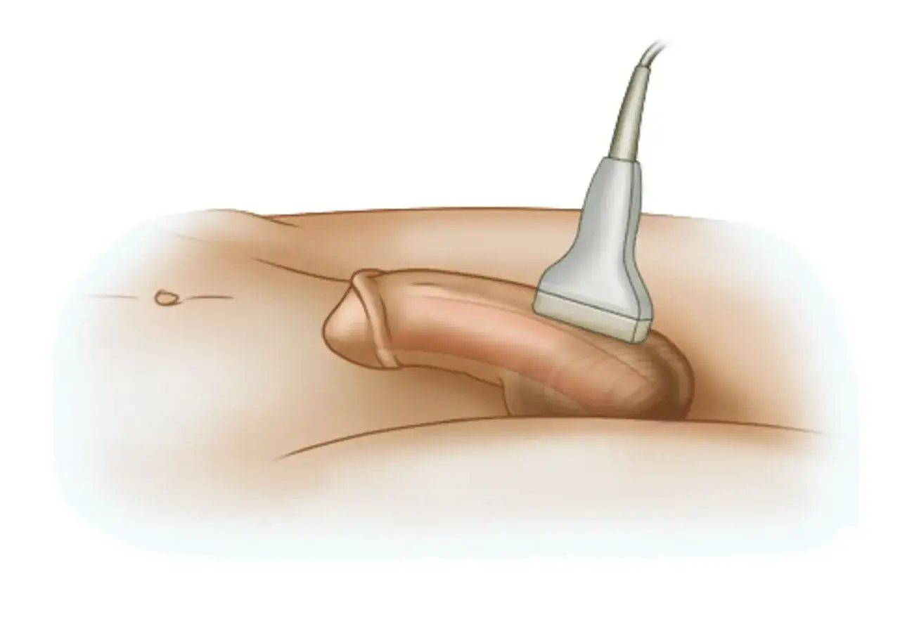 Diagnostyka zaburzeń erekcji