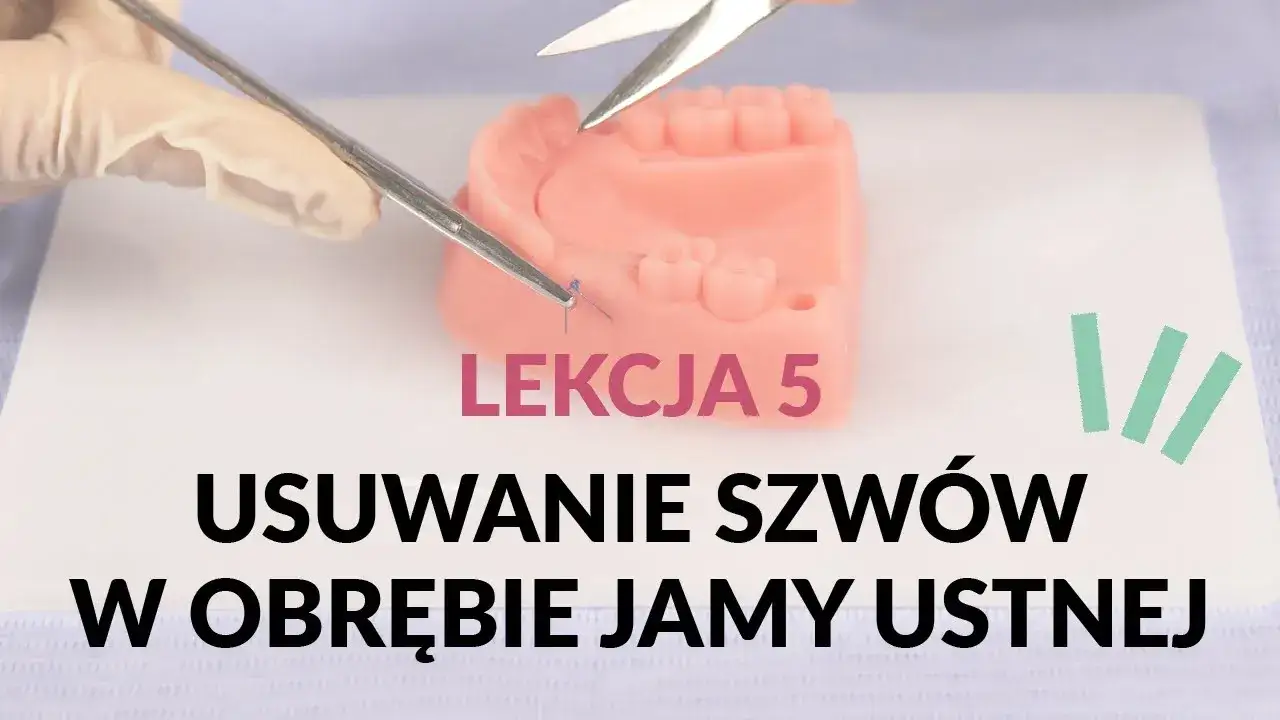 dentysta usuwanie szw&oacute;w dziąsło
