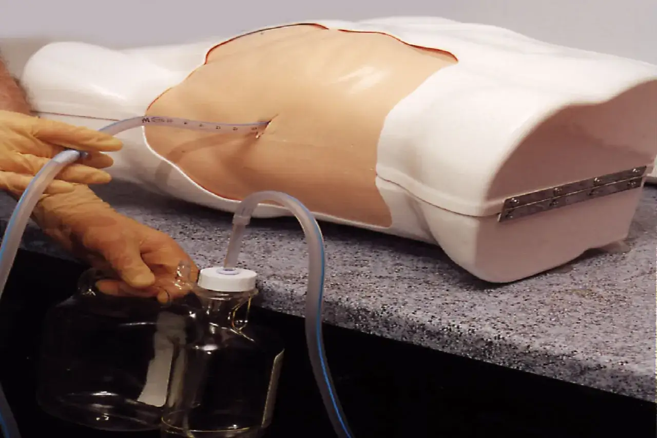 Symulacja drenażu jamy opłucnej. Leczenie odmy płucnej może trwać r&oacute;żnie, zależnie od jej wielkości i przyczyny.