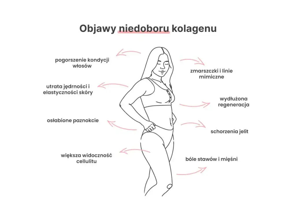 objawy niedoboru kolagenu sk&oacute;ra stawy