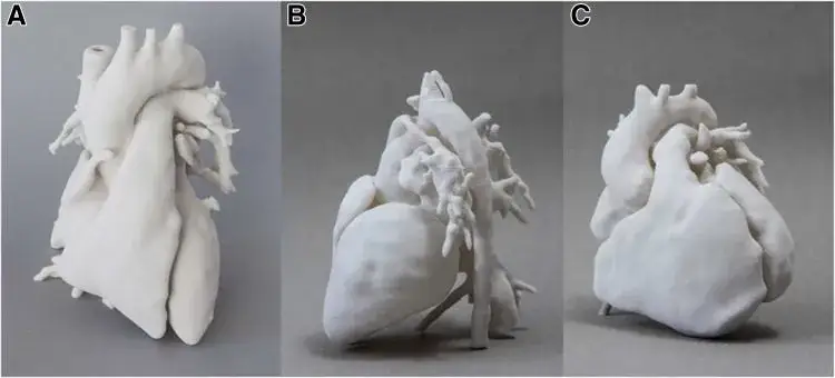 Przykłady wydruków 3D w medycynie