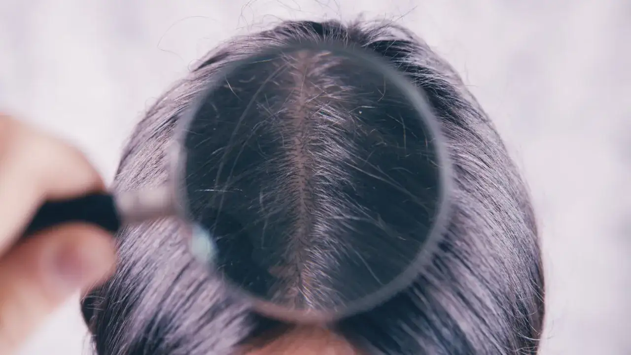 Dłoń trzymająca lupę bada sk&oacute;rę głowy, ukazując rozdwojone włosy na całej długości.