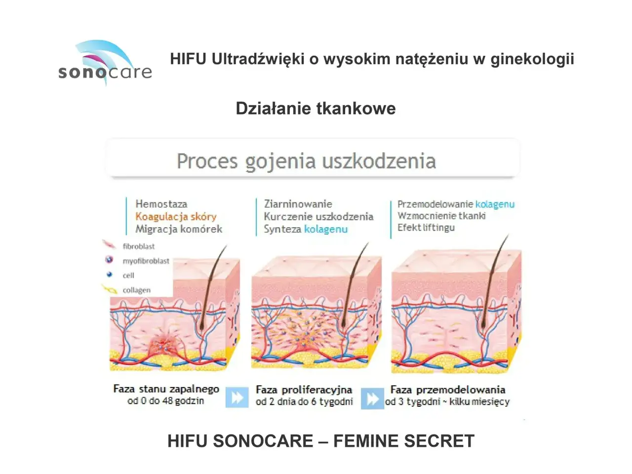 schemat działania ultradźwięk&oacute;w na tkanki