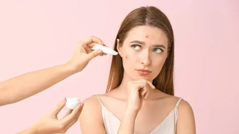 błędy w pielęgnacji cery trądzikowej, nie wyciskaj pryszczy