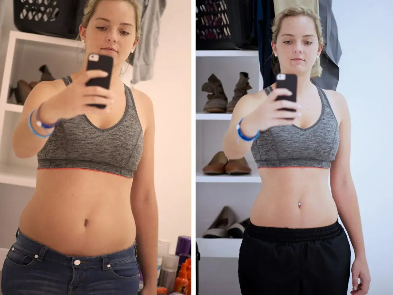 Przed i po: widoczne liposukcja brzucha efekty. Kobieta w sportowym topie i jeansach, potem w szortach, pokazuje smuklejszą sylwetkę.