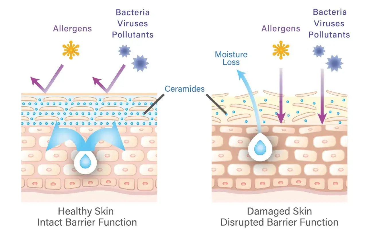 Por&oacute;wnanie zdrowej i uszkodzonej sk&oacute;ry. Kremy z ceramidami wzmacniają barierę ochronną, zapobiegając utracie nawilżenia i wnikaniu alergen&oacute;w.