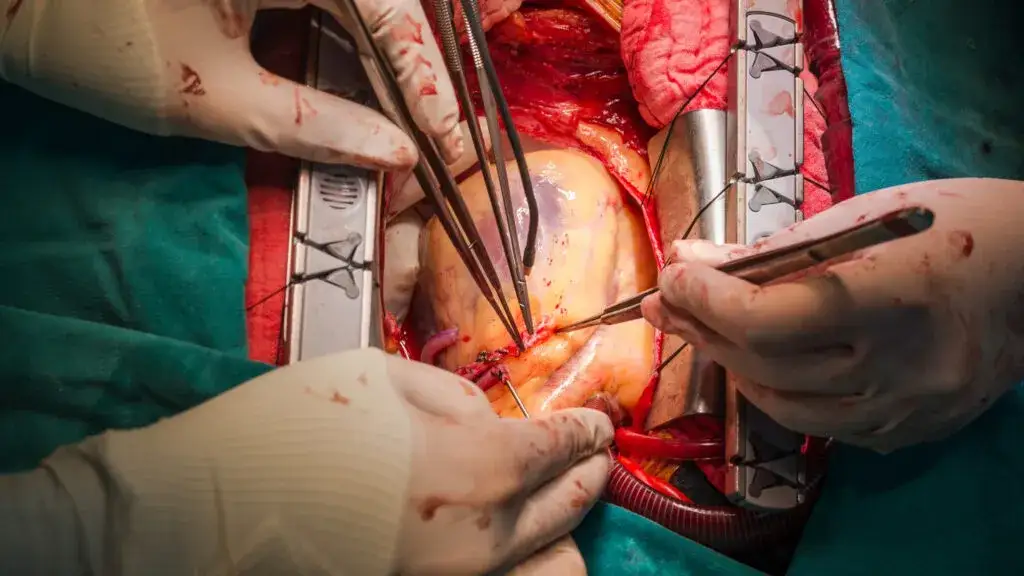 Zdjęcie Rehabilitacja po bajpasach gdzie znaleźć najlepsze ośrodki i programy