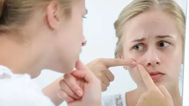 Zdjęcie Jak wysuszyć pryszcze szybko i skutecznie - sprawdzone metody