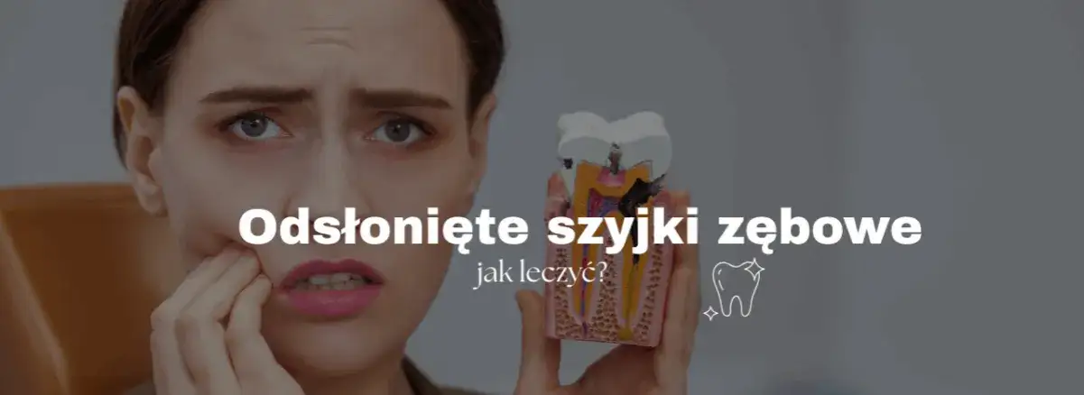 Zdjęcie Jak skutecznie leczyć odsłonięte szyjki zębowe i uniknąć bólu – porady i metody