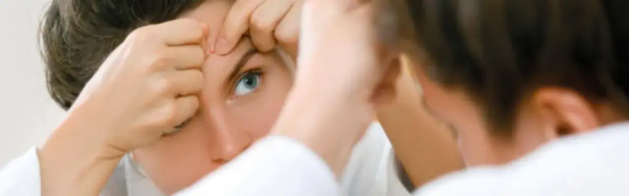 Zdjęcie Czy pryszcze same znikają? Sprawdź, kiedy potrzebna jest pomoc dermatologa