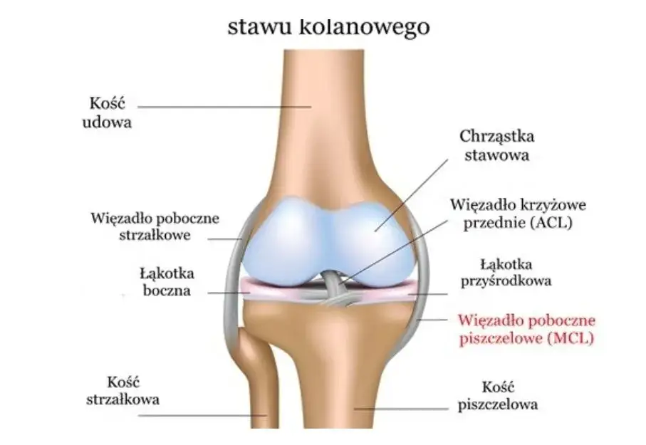 Zdjęcie Naciągnięte więzadła w kolanie: 7 objawów, które musisz znać