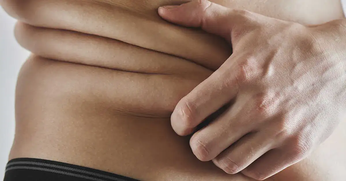 Zdjęcie Czy mężczyźni mają cellulit? Poznaj prawdę o męskiej skórce pomarańczowej