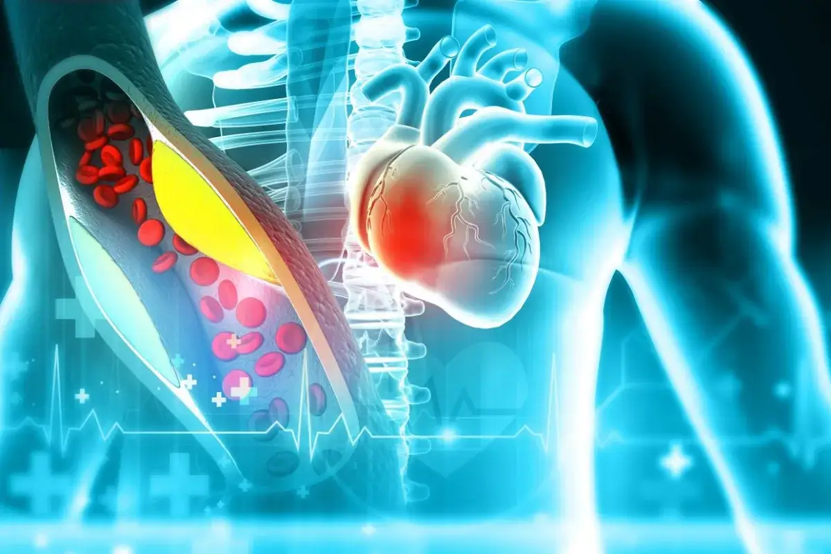 Zdjęcie Czy leki na cholesterol są szkodliwe? Odkryj prawdę o statynach