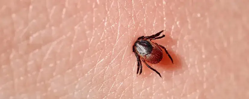 Zdjęcie Ugryzienie kleszcza objawy - poznaj groźne symptomy i jak je rozpoznać