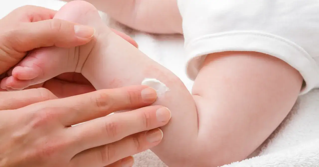 Zdjęcie Uczulenie na sierść u niemowląt objawy – jak je rozpoznać i leczyć