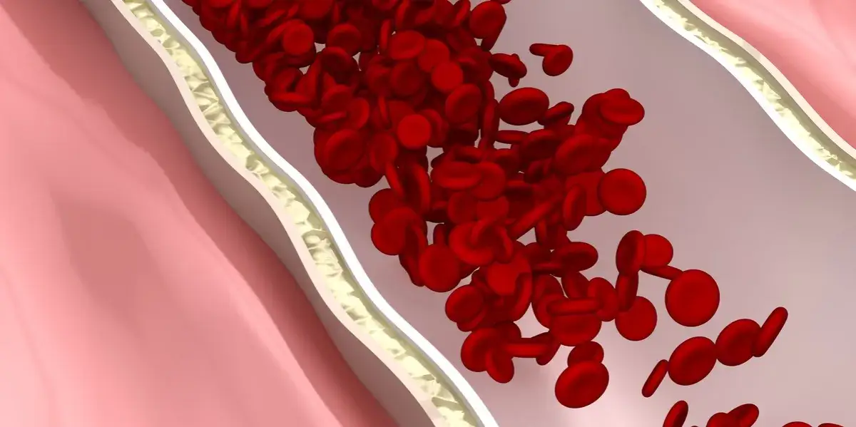 Zdjęcie Zaburzenia krzepnięcia krwi objawy - nie ignoruj tych sygnałów zdrowotnych