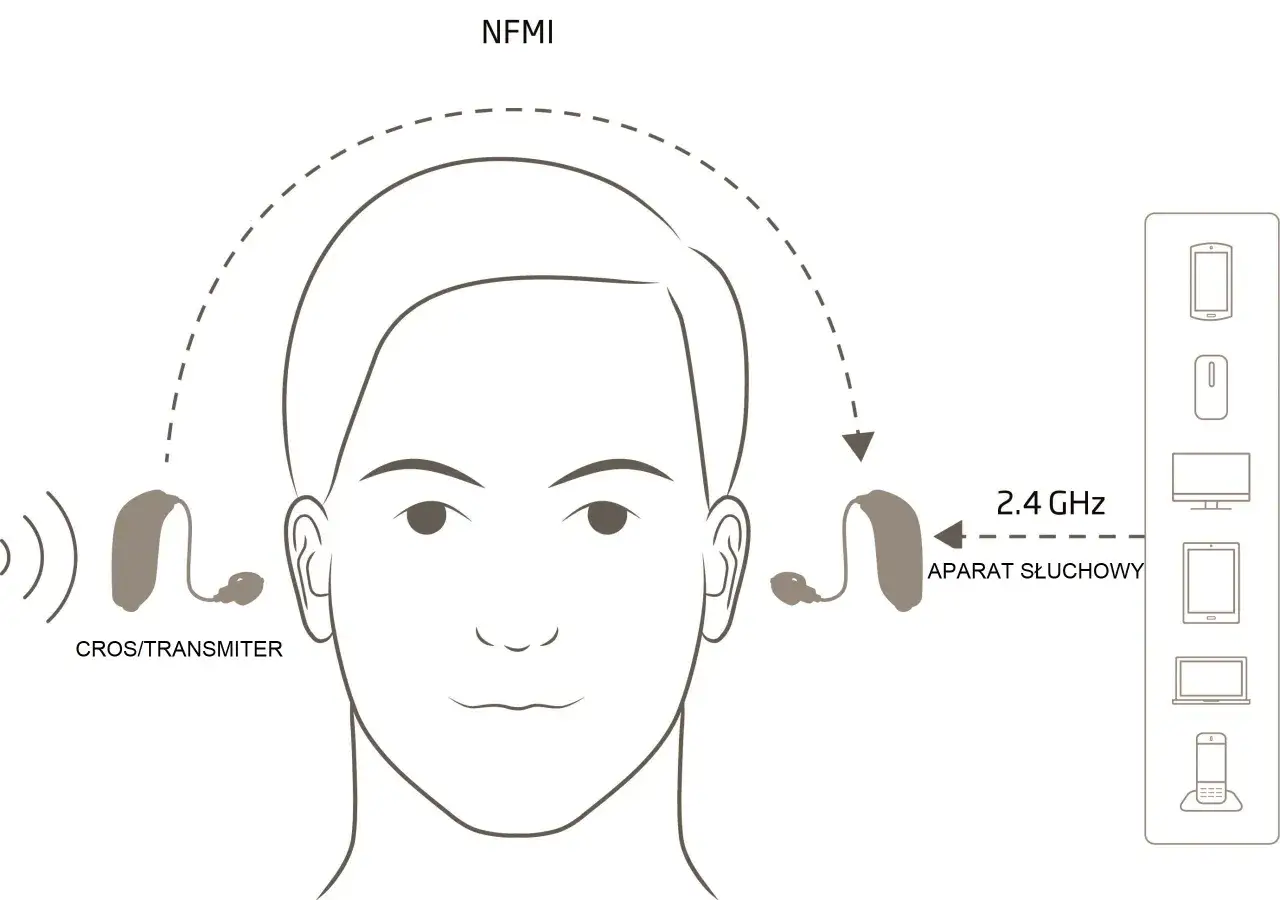Zdjęcie Jak założyć aparat słuchowy - proste kroki, które ułatwią życie