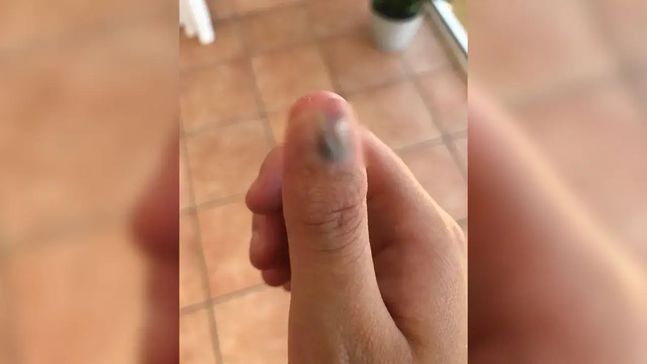 Zdjęcie Dlaczego obgryzasz paznokcie? Przyczyny, skutki i jak przestać