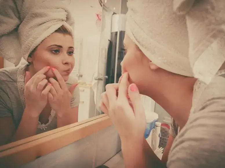 Zdjęcie Jak zapobiec pryszczom - skuteczne sposoby na zdrową skórę