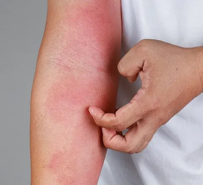 Zdjęcie Co to jest AZS u dziecka? Objawy, przyczyny i skuteczne leczenie