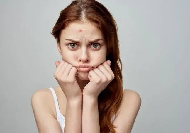 Zdjęcie Jak pozbyć się pryszcza w 5 minut - szybkie sposoby na ulgę