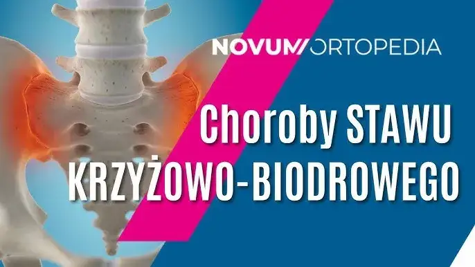 Zdjęcie Jakie leczenie i lekarz przy zapaleniu stawu krzyżowo-biodrowego?