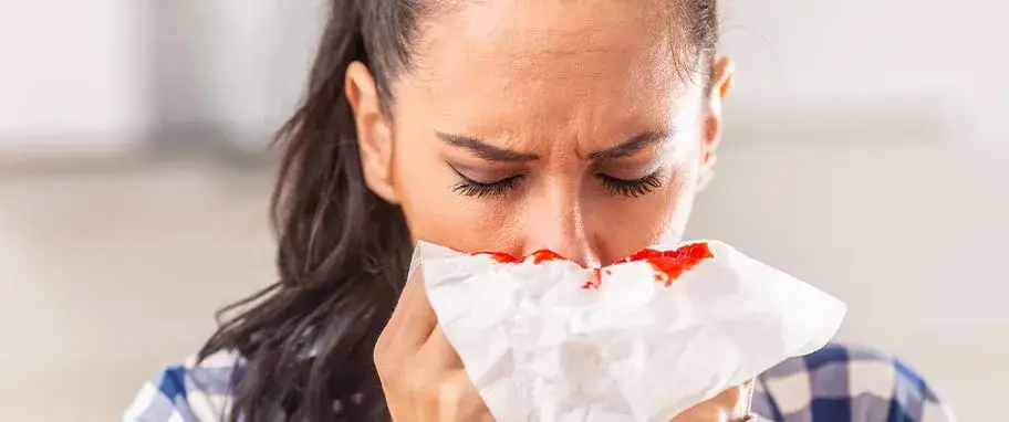 Zdjęcie Przyczyna krwawienia z nosa: najczęstsze powody i jak ich unikać