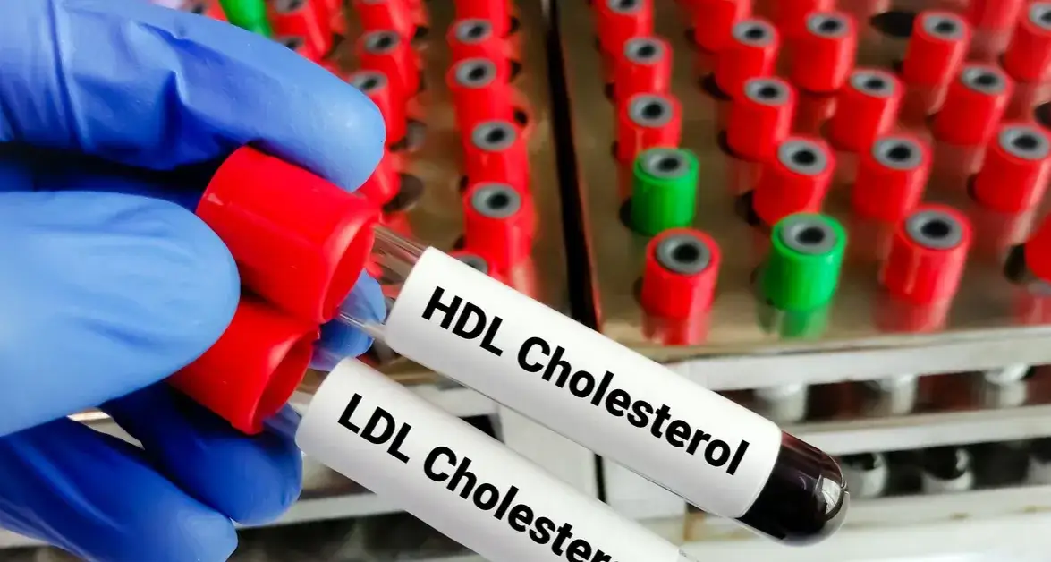 Zdjęcie Czy alkohol wpływa na cholesterol? Poznaj prawdę o jego skutkach