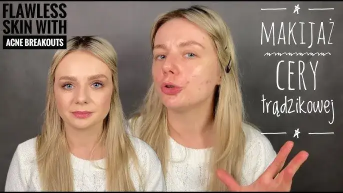 Zdjęcie Jak ukryć pryszcze makijażem? Uzyskaj efekt bez maski!