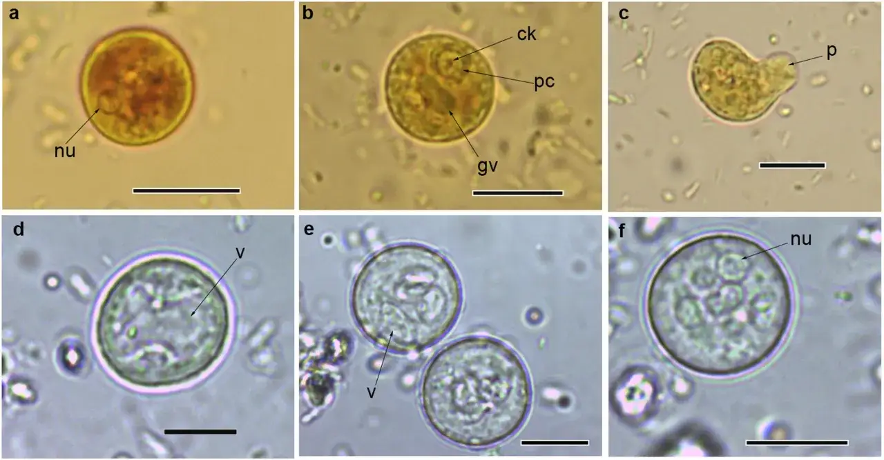 Zdjęcie Entamoeba histolytica vs Endolimax nana: Objawy, leczenie