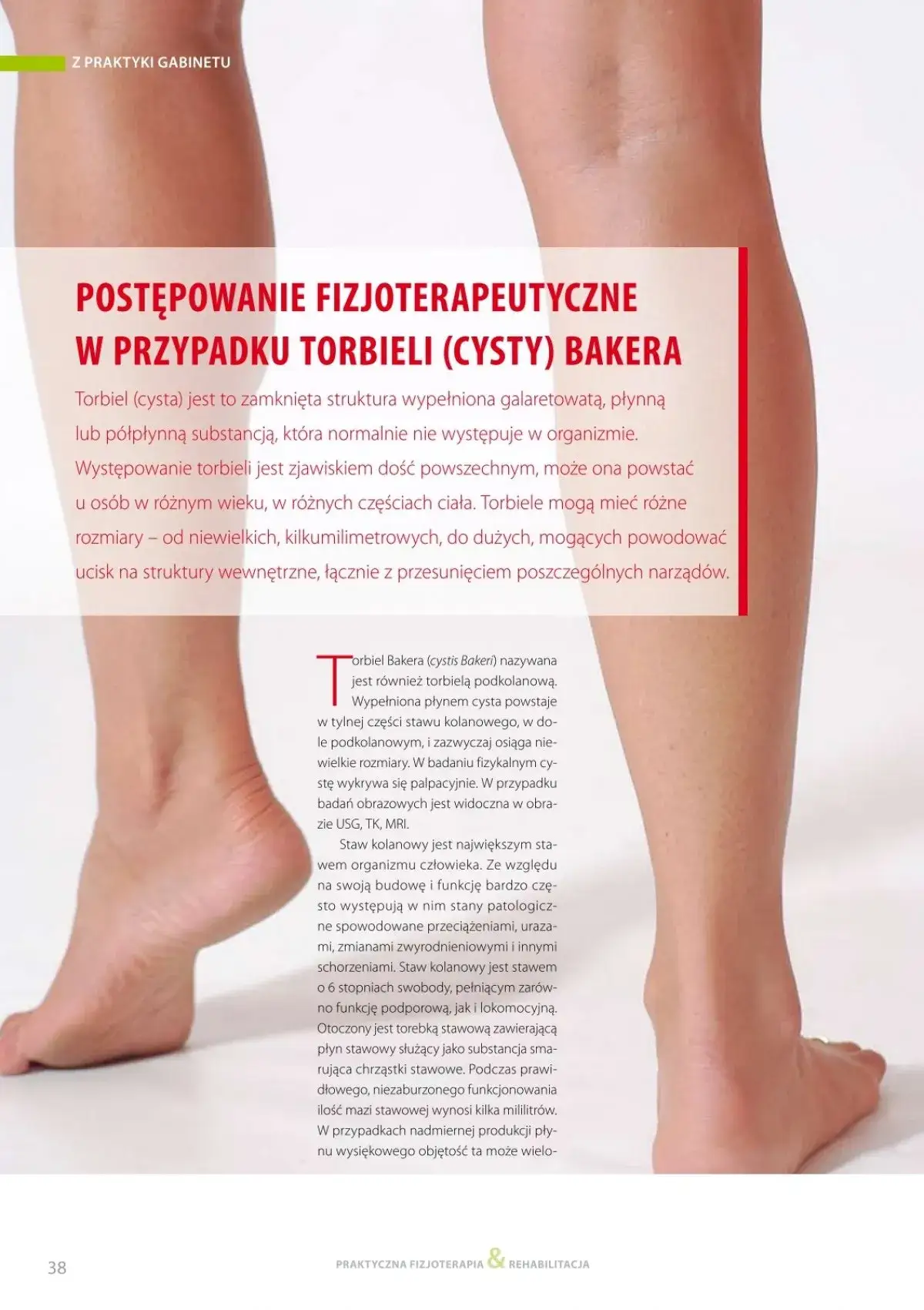 Zdjęcie Najskuteczniejsze leki na torbiel Bakera - sprawdzone metody leczenia