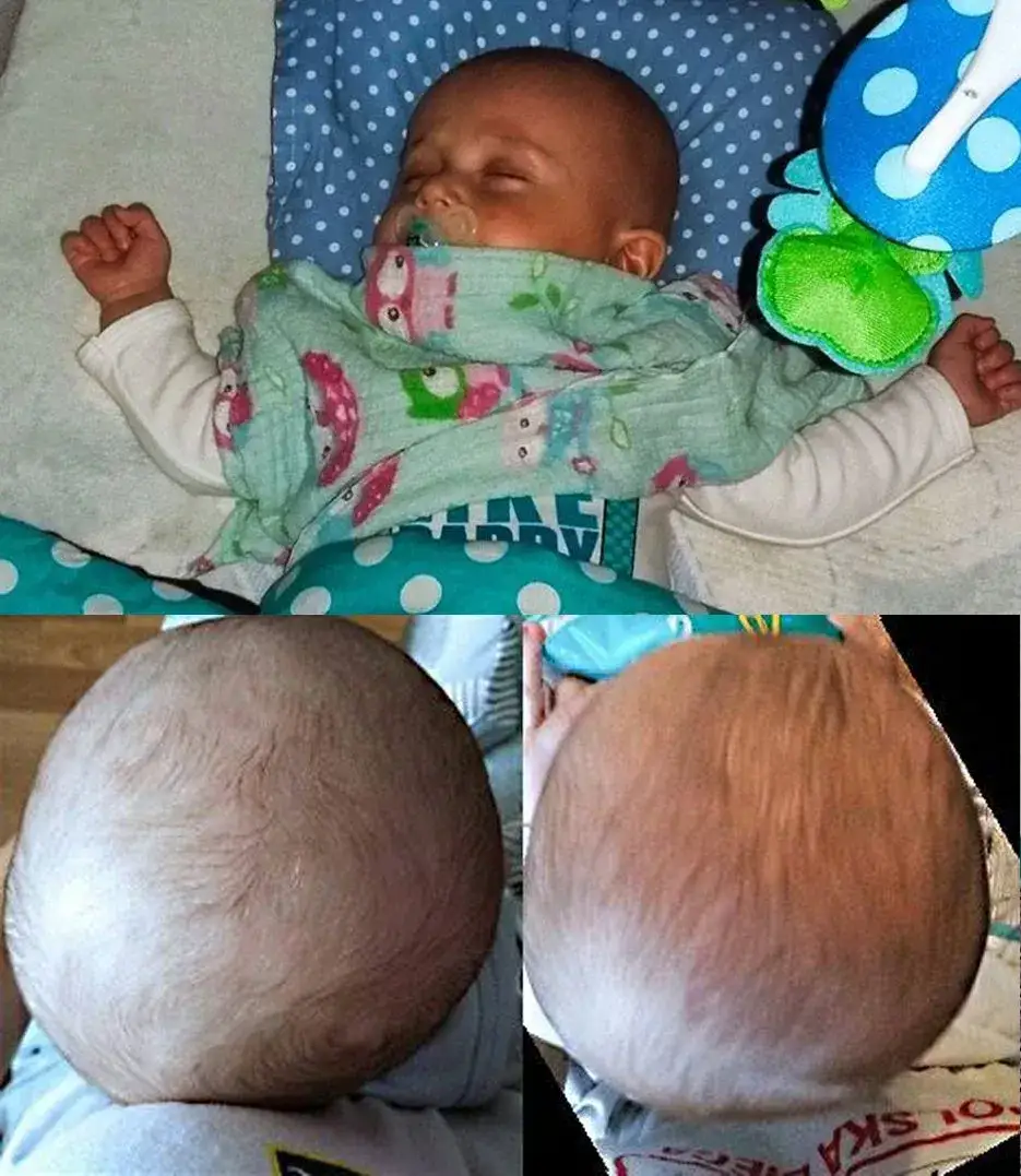 Zdjęcie Jak układać dziecko na poduszce Head Care, aby uniknąć deformacji