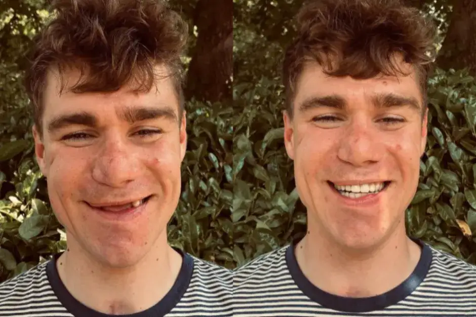 Zdjęcie Jakobsen kolarz: dramatyczny wypadek i niezwykła rehabilitacja