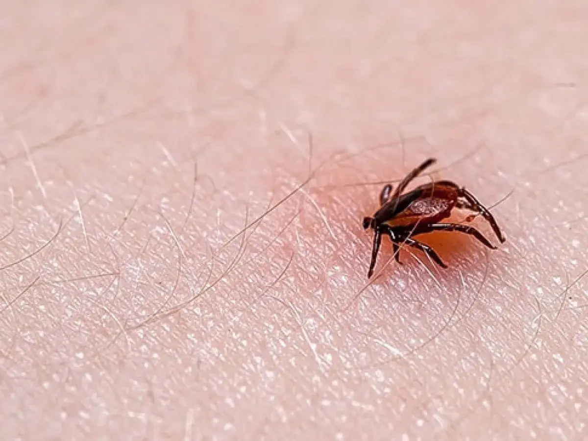 Zdjęcie Cómo matar una garrapata de forma segura y evitar infecciones