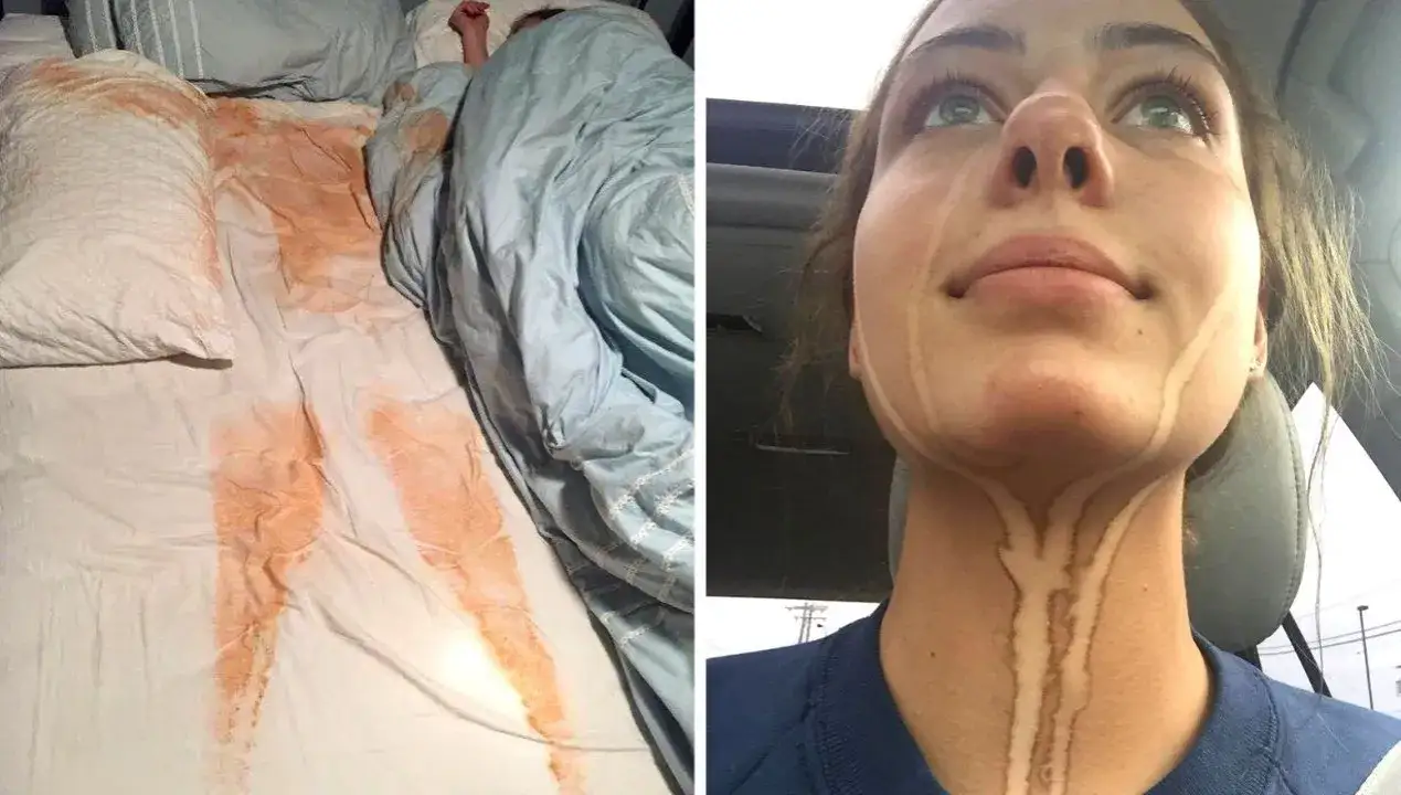 Zdjęcie Jaki peeling przed samoopalaczem, aby uniknąć smug i plam?